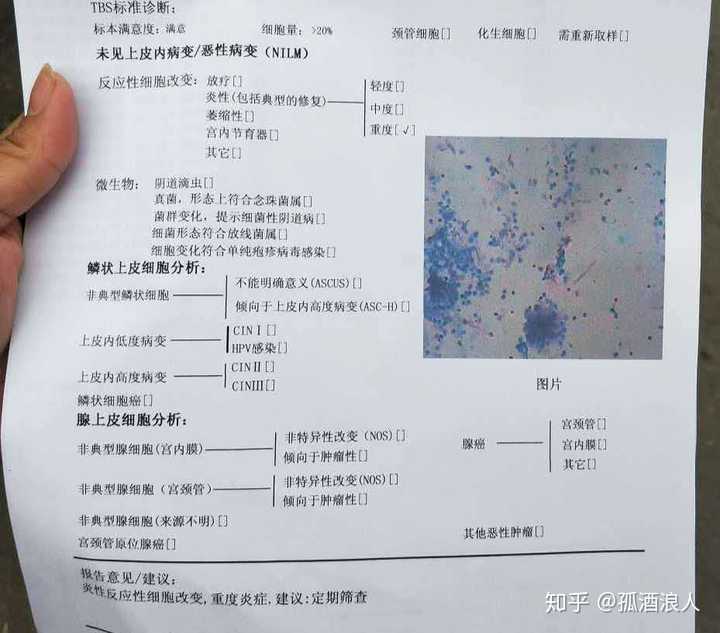 两个月前早上一个刚毕业的女孩问我hpv52高危是不是恢复的比较慢,她