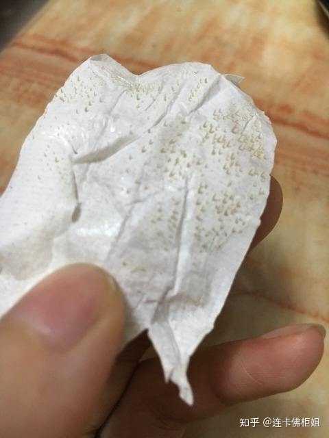 因为有一种可能就是皮肤太干,油脂粒埋得太深) 黑头是" 开放性粉刺"