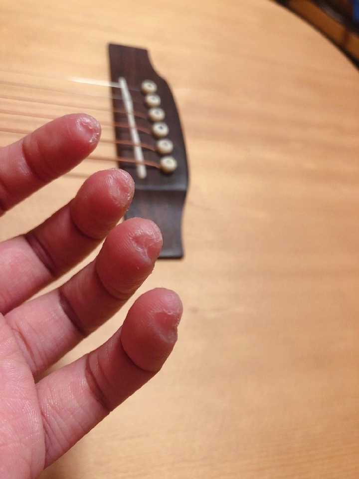 练吉他的时候左手按弦手指尖疼而且爆皮了怎么办?