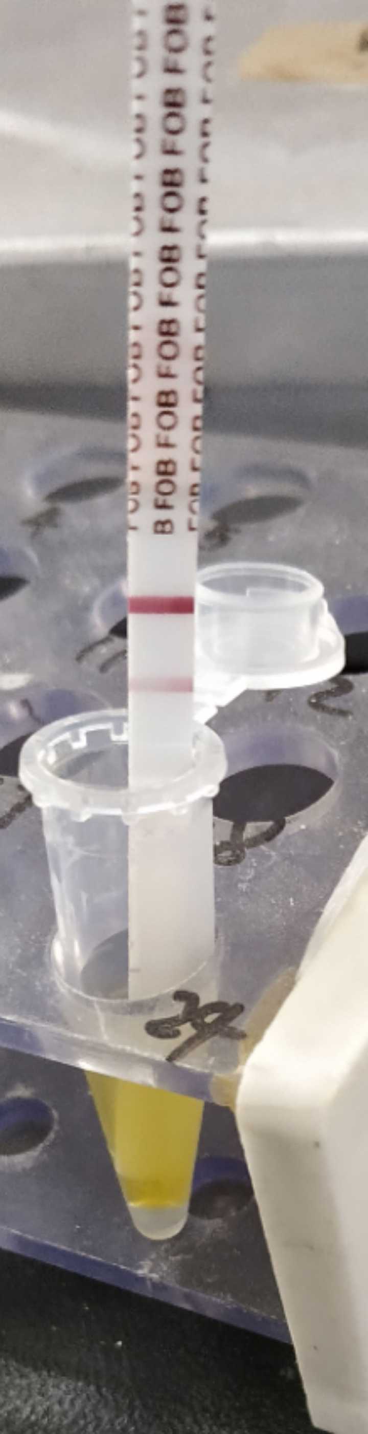 成人拉肚子(拉水)怎么办?
