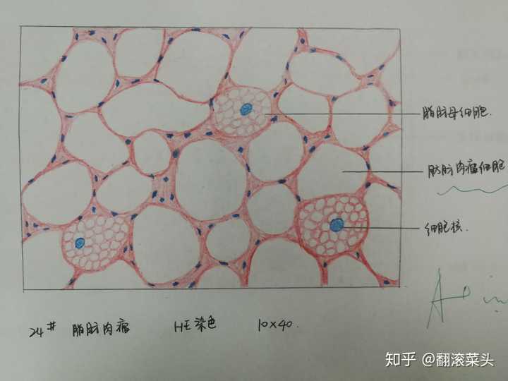 为什么咱们不弄个病理红蓝手绘图的问题呢?