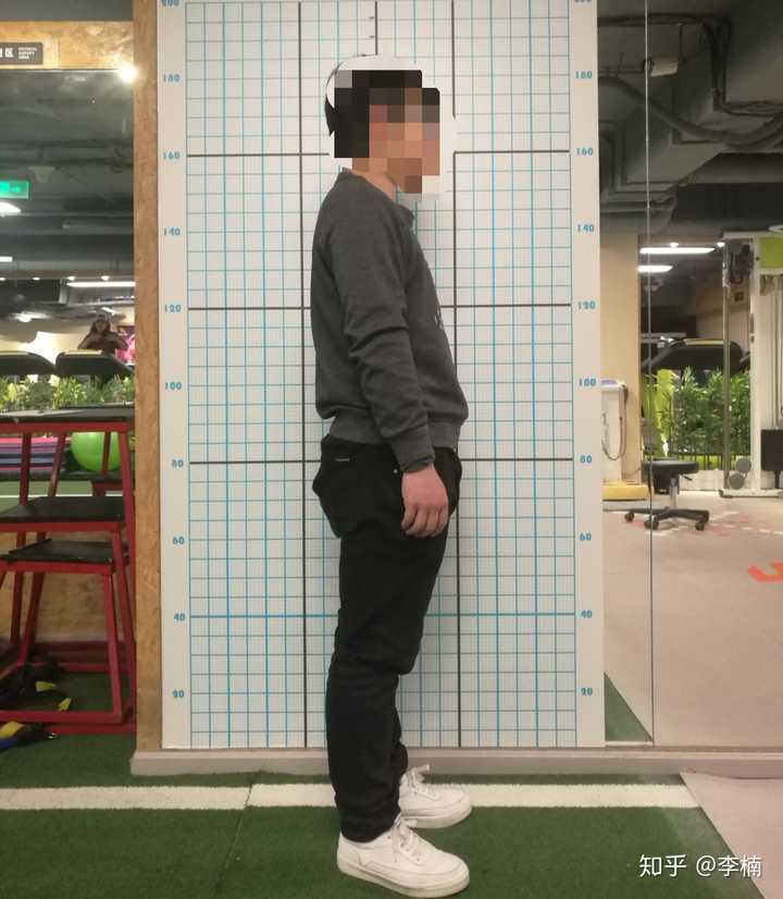 驼背骨盆前倾问题,你可以拍个照片进行对比一下自己的体态是否有一致