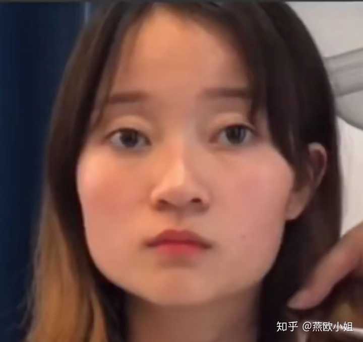 国字脸女生一定要削骨吗?