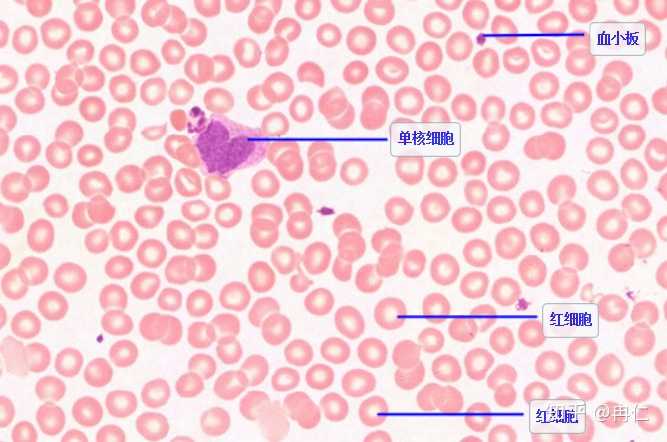切片和涂片血细胞为什么大小不一样?