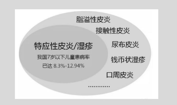 皮炎(ad/过敏体质类型湿疹)是婴幼儿时期最常见的皮炎湿疹类皮肤疾病