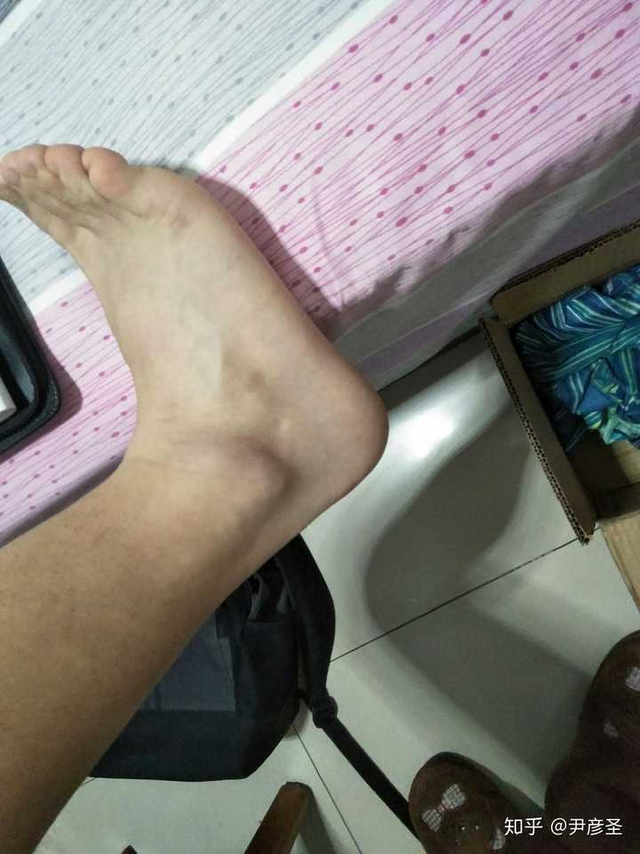 脚踝受伤的一个月,这是踢球的脚踝
