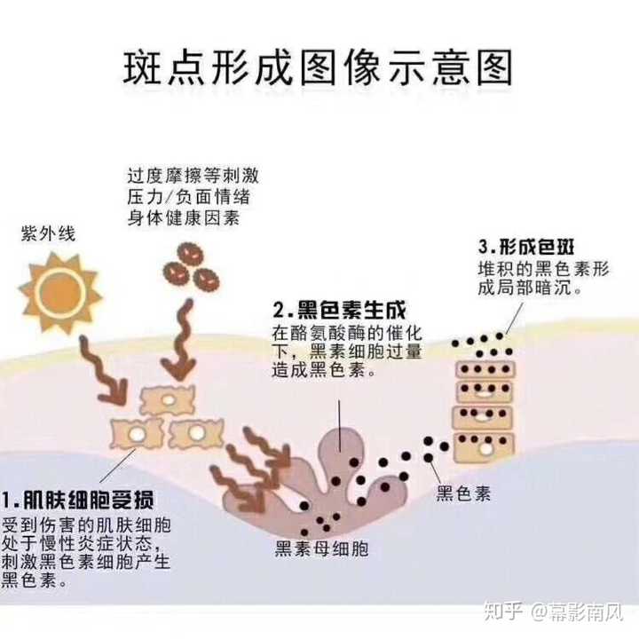 脸上有雀斑和黄褐斑怎么去除?