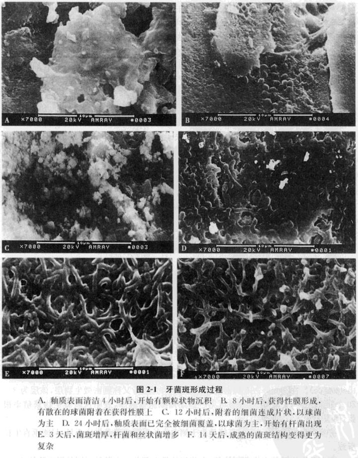 从口腔保健方面看,早起刷牙是预防龋病和牙周病既经济又有效的方法,其