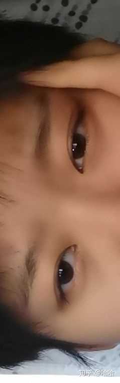 得了抑郁症的人眼神是不是都是一样的?
