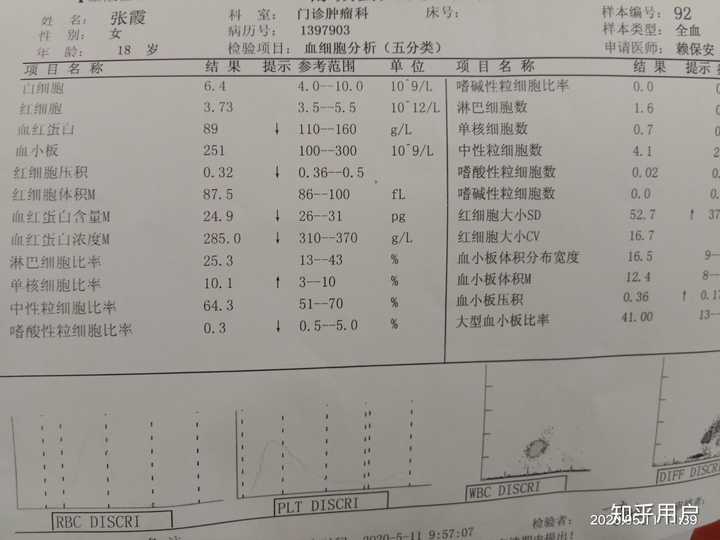 非霍奇金淋巴瘤,这病能活多久呢?