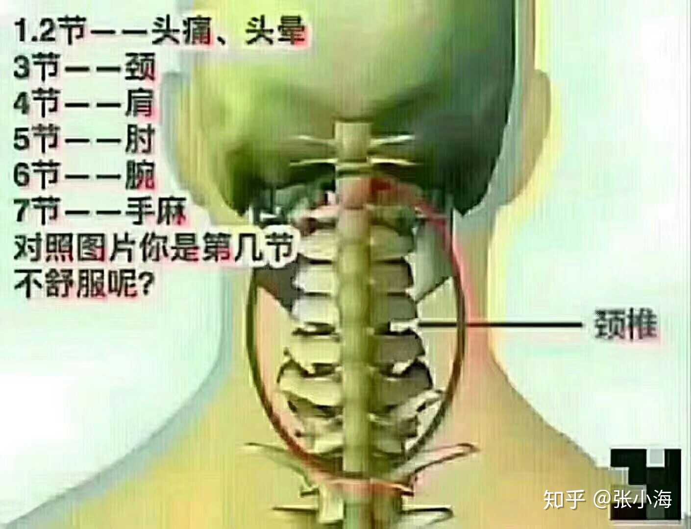 人体颈椎分为七节,不同的位置出现状况所引起的症状都是不一样的