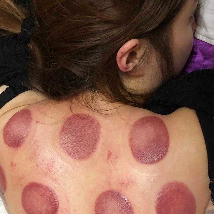 怎么才能彻底去湿气?