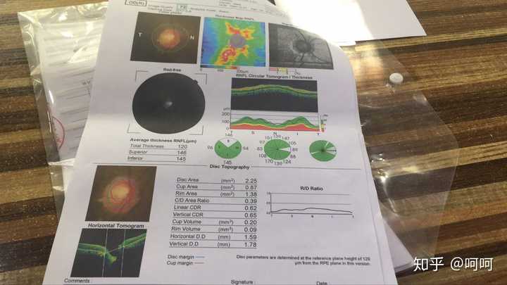 今天做了oct检查,请大神给我一些眼睛上的建议?