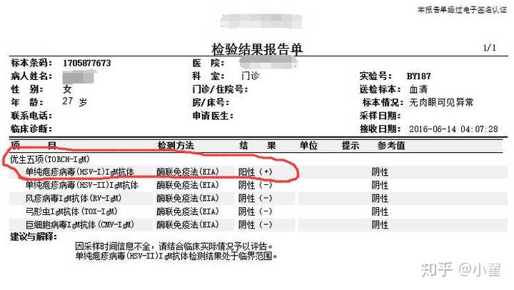 孕后torch检查,单纯性疱疹病毒igg,igm均偏高,胎儿能要吗?