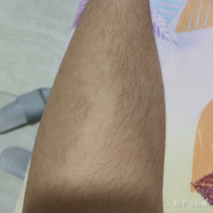 体毛比较多的女生,该咋整呀?