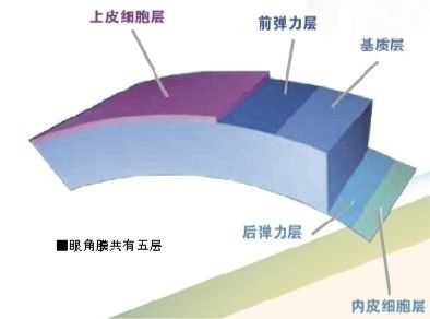 而发生在角膜任何一层的炎症,都可称为角膜炎.