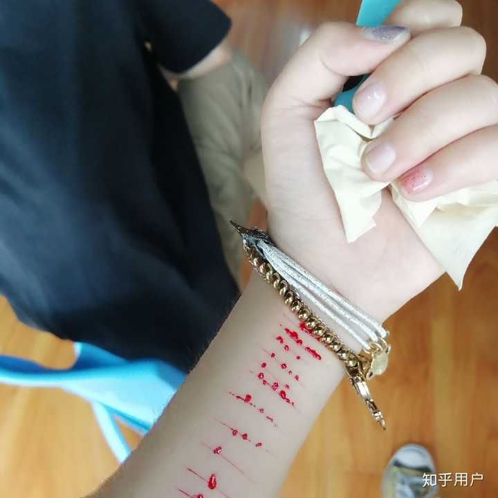 抑郁症患者眼中世界是什么样的?