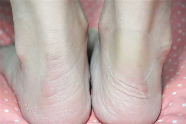 做法: 将海绵双面胶贴在鞋子脚后跟处内侧,然后把贴近脚的另外一面胶