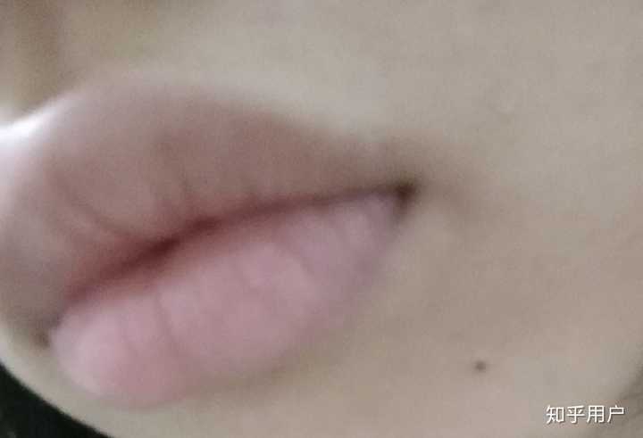 别人都说厚唇性感,性感个屁.因为唇形不好看,上唇太厚,凸嘴贼严重.