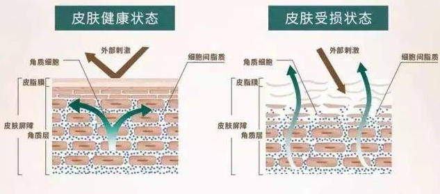 角质细胞老是 浸泡在水里,角质可能过度水合,变得脆弱,耐受力下降