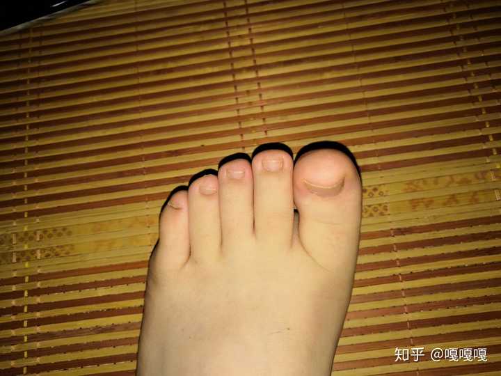 女生拥有一双罗马脚是什么体验?