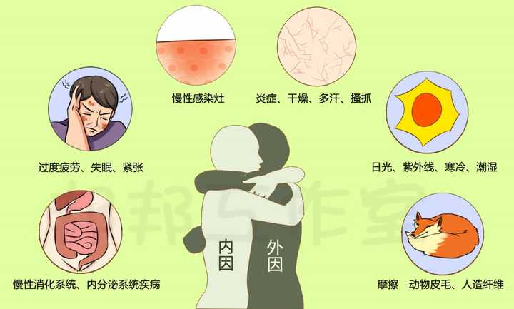 湿疹要痒疯了?