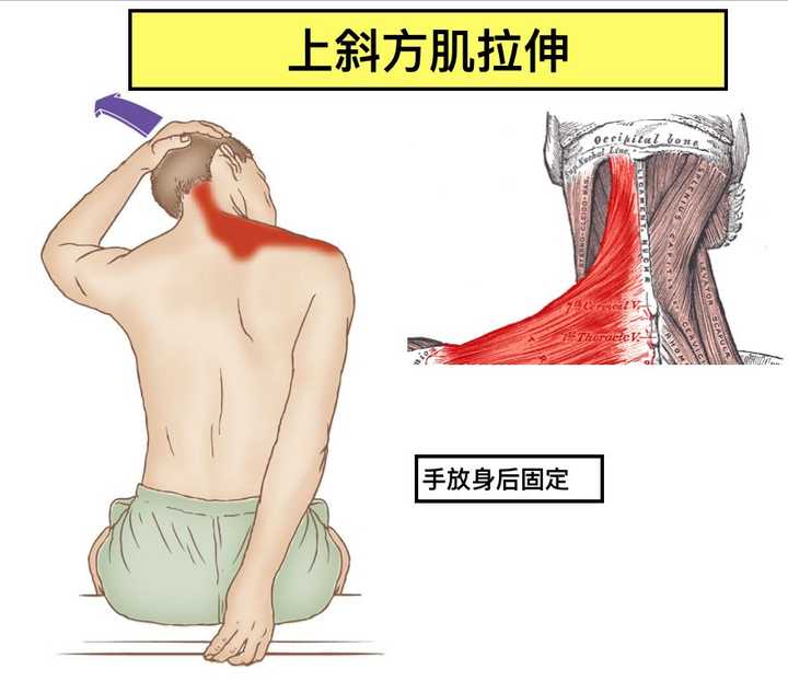 由于长期头前倾还会造成耸肩的问题,我们要拉伸提肩胛肌.