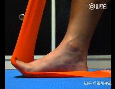 扁平足能不能跳绳?会不会很容易受伤?
