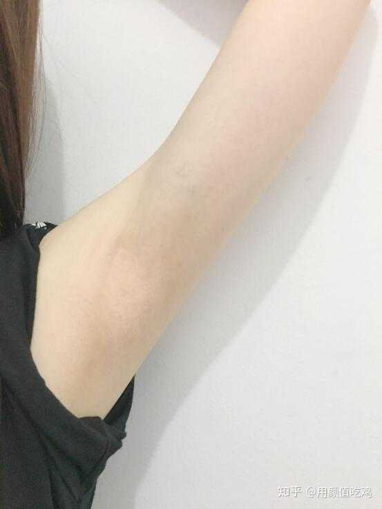 女生长期脱毛是什么体验?