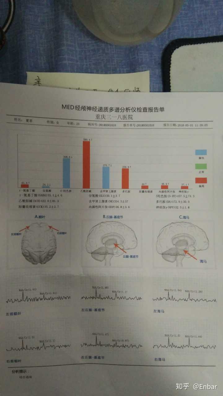 请问med经颅神经递质多谱分析仪真的管用吗?