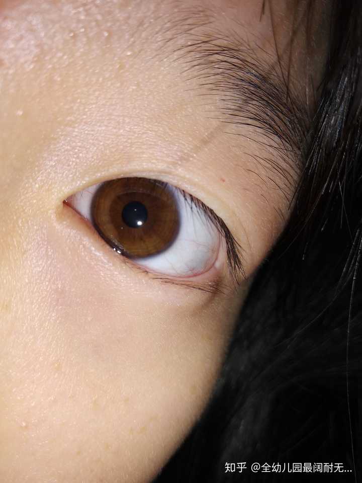 中国人眼球不是黑色么?为什么好多人是棕色的(我就是)