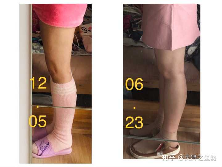 腿从侧面看超级粗 大腿前侧很突出 怎么办?