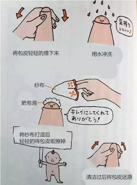 男生包茎一定要割包皮吗?