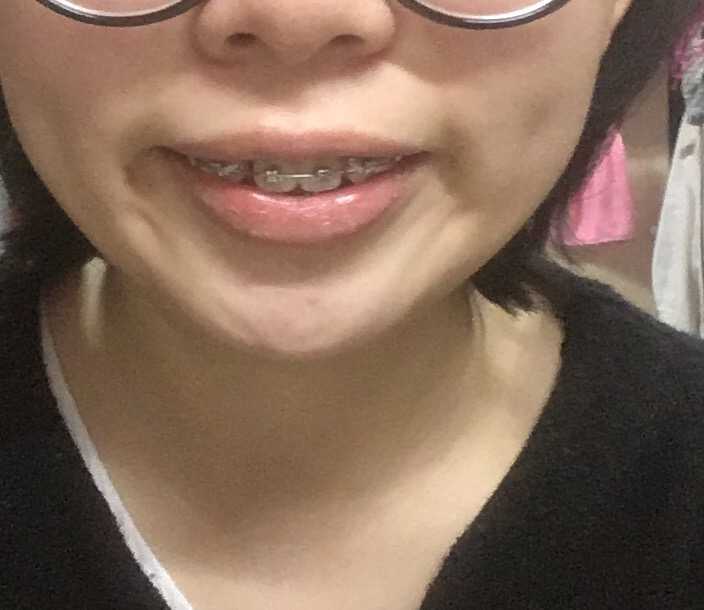 还有就是感觉最近的酒窝明显了 而且出现了梨涡
