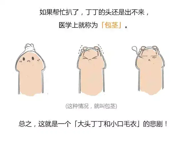 男孩子天生就是包皮过长的,因为包皮有保护作用,那叫做「生理性包茎」