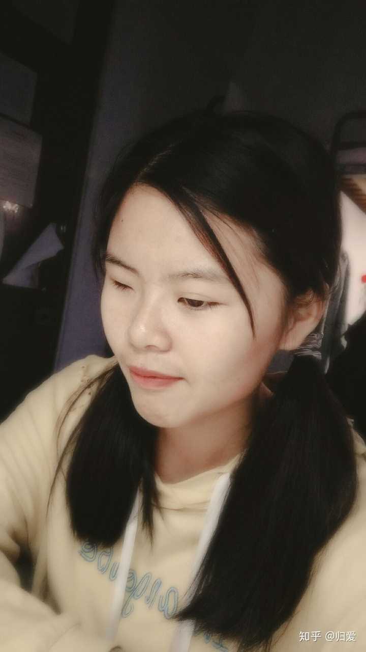 单眼失明是种怎样的体验?
