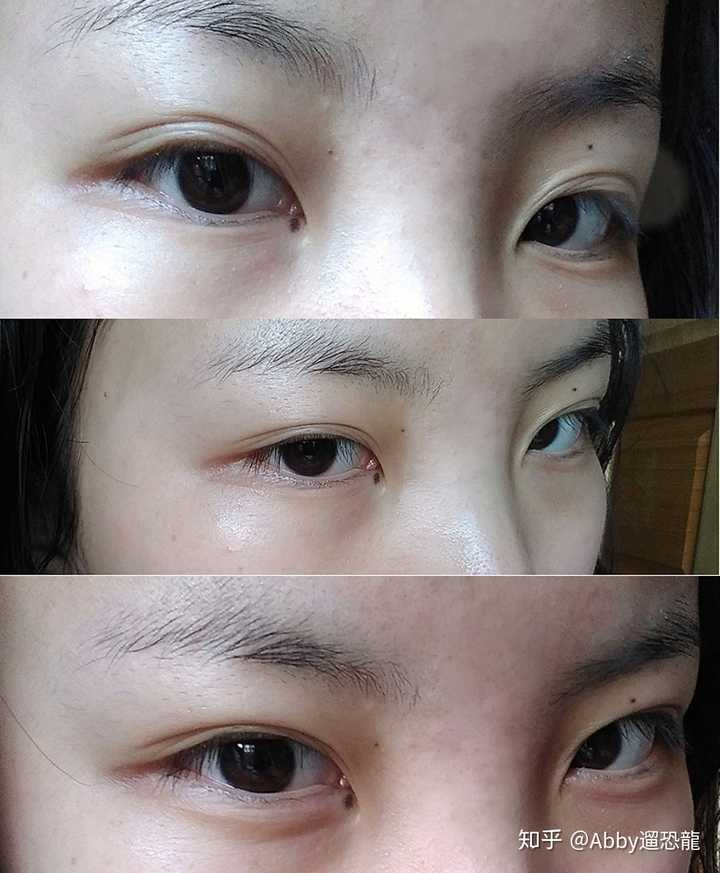 内眼角有痣是一种怎样的体验