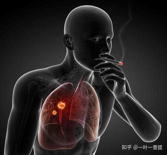 吸烟患肺癌的几率有多大?