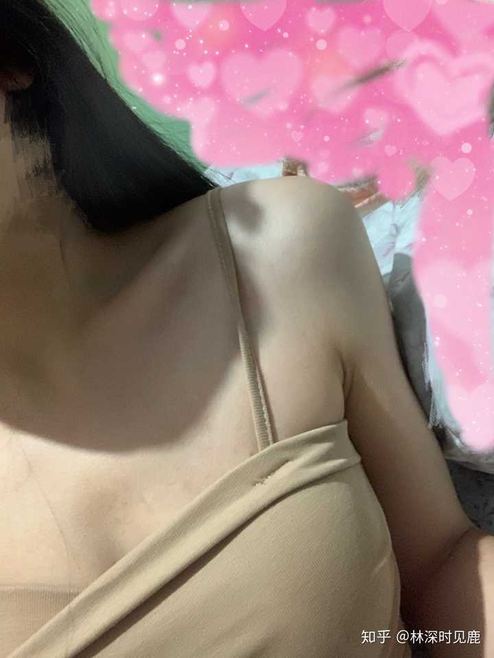 人的锁骨形状分类有几种?
