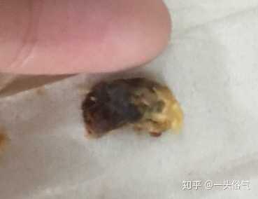 耳屎最大能有多大?