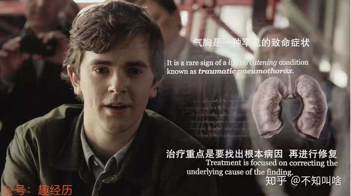 哦对了,这部剧里面还有李现~ 自闭症的主角shaun murphy肖恩·墨菲