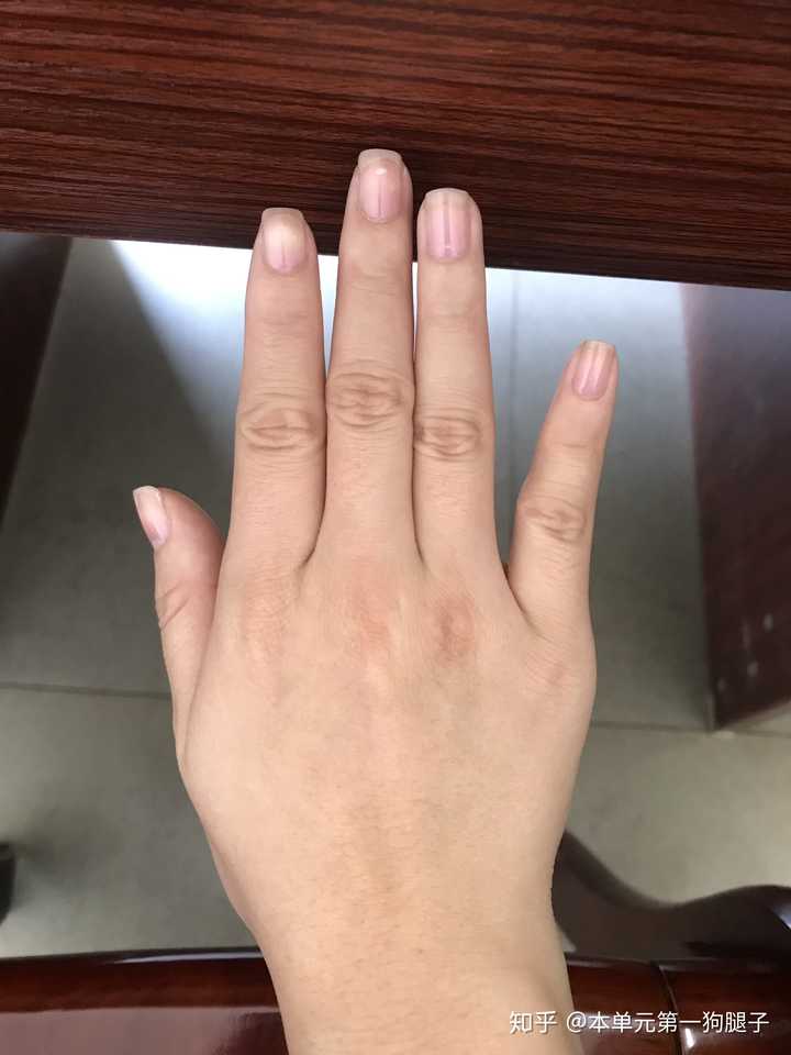 甲床过短应该如何变长?