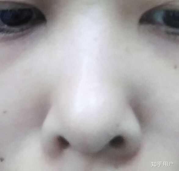 朝天鼻是一种怎样的体验?