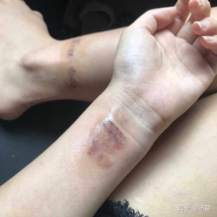 洗纹身是种什么样的体验?