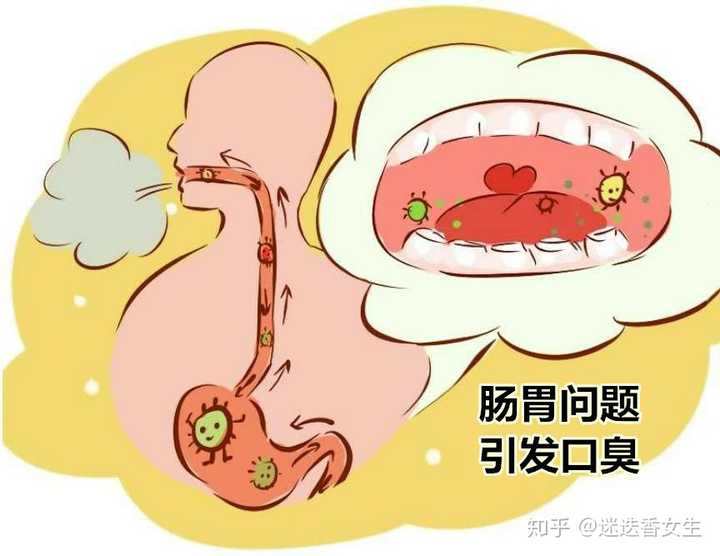 如何分辨口臭是口腔问题还是肠胃问题?