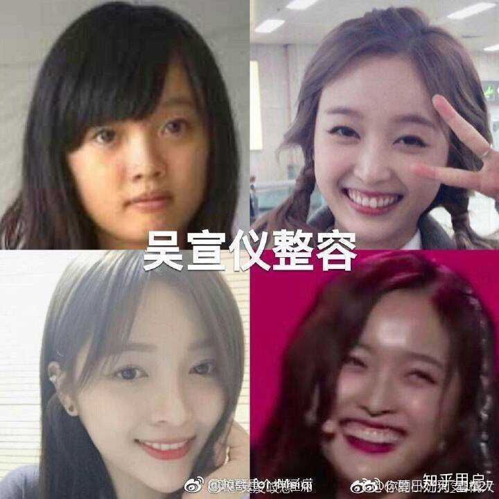 火箭少女的吴宣仪是整容了吗?