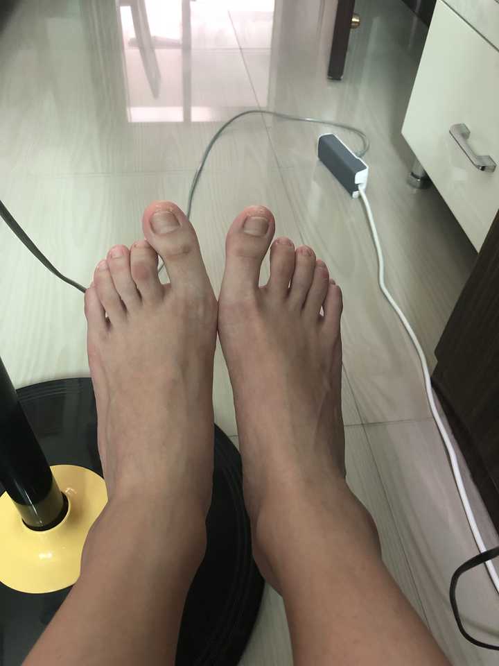 女生脚丑是种什么样的体验?