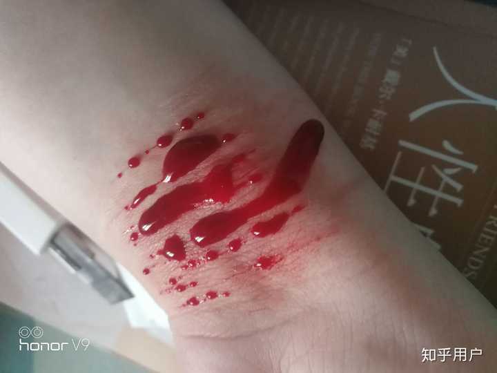 是不是自残过的人都会对自残上瘾,然后不管疼痛,不论伤疤,纵使知道会