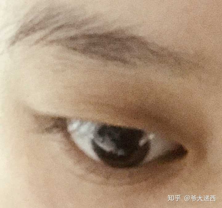 为什么眼睛下面会有一道像双眼皮长反了一样的纹?