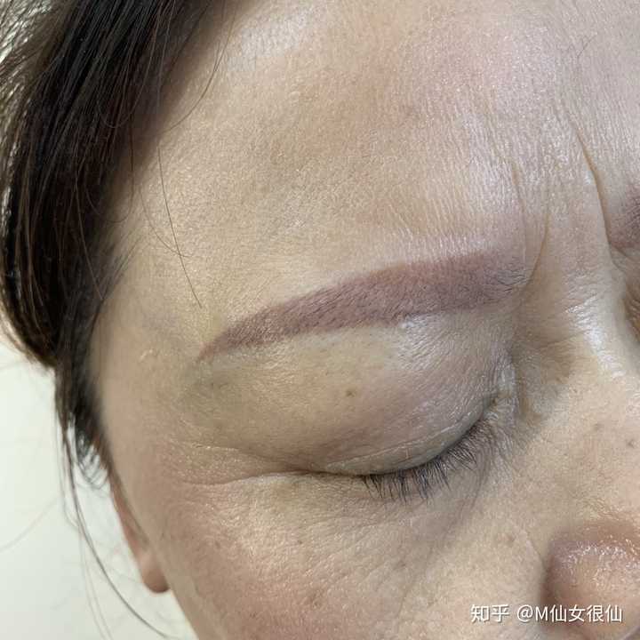 如果你的眉毛是被纹毁了的状态,发红,发蓝,或者是很粗很黑,如下图